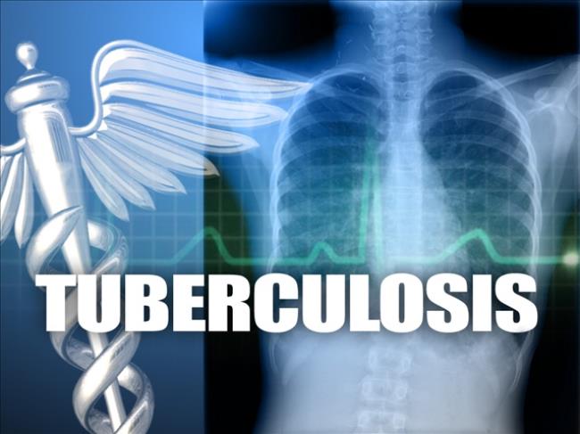 Commentary: Time For Action To End Tuberculosis