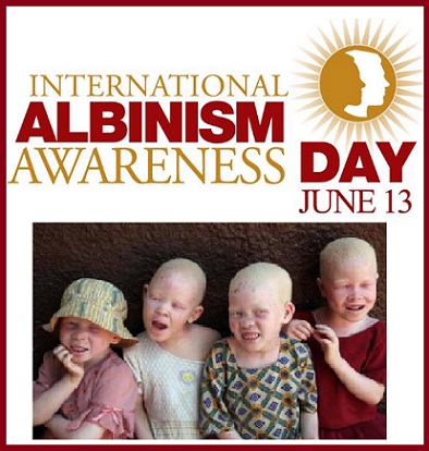 Today Is International Albinism Awareness Day