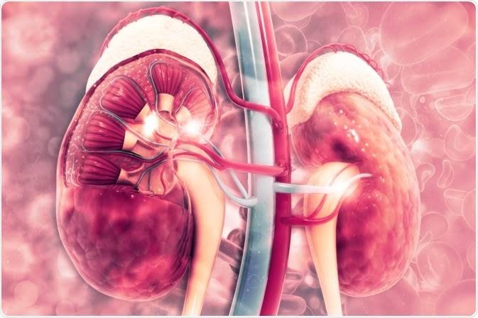 Tackling Nigeria’s rising kidney disease cases