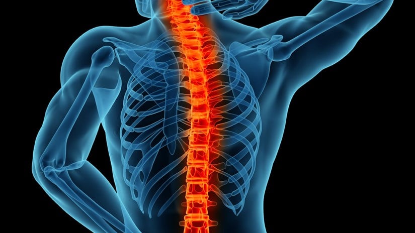 Commentary: Avoiding Back Surgery Through Physiotherapy